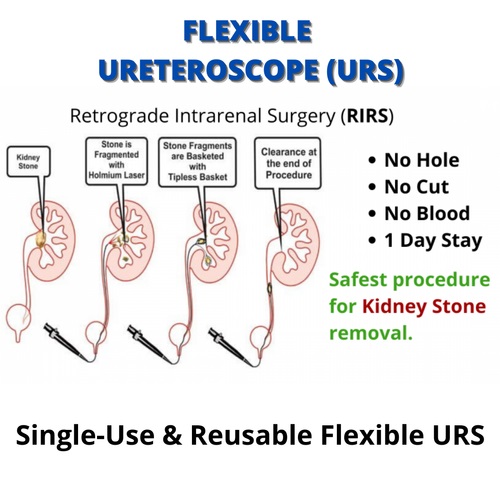 URS Single Use Flexible Video Uretero-Renoscope